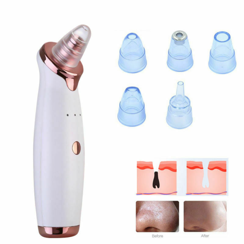 Electric Blackhead Remover Pore Vacuum Suction Dermabrasion Face Cleaner New