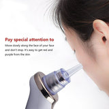 Electric Blackhead Remover Pore Vacuum Suction Dermabrasion Face Cleaner New