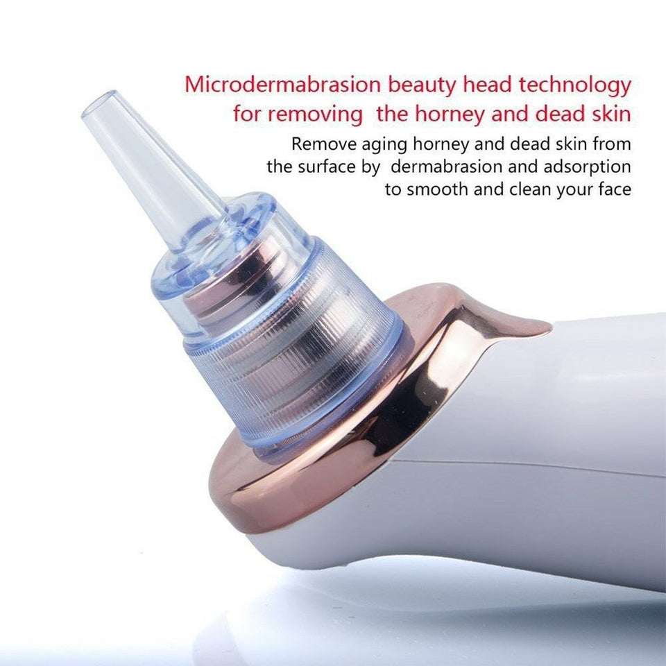 Electric Blackhead Remover Pore Vacuum Suction Dermabrasion Face Cleaner New